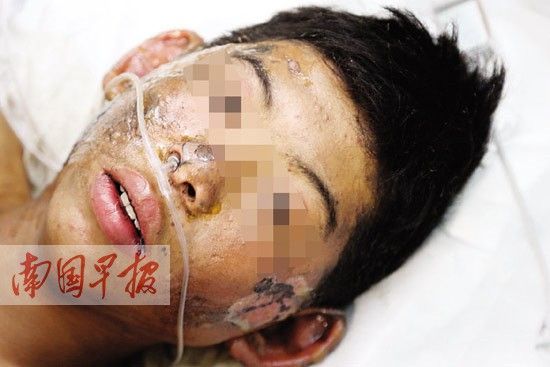 廣西：迎親車上20余萬響鞭炮被引燃 5人被炸傷(圖)