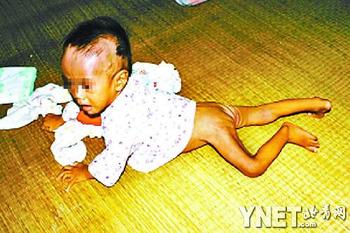 8個(gè)月嬰兒被母親遺棄在家 餓8天瘦成皮包骨