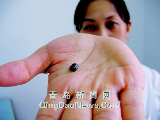 衛(wèi)生部發(fā)布“蜱的特點及預防控制知識”