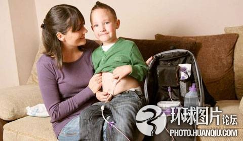 難以置信的罕見(jiàn)怪病：忘記呼吸 靜電過(guò)敏 聽(tīng)鬧鐘響心臟停跳
