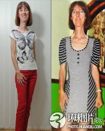 難以置信的罕見怪?。和浐粑?靜電過(guò)敏 聽鬧鐘響心臟停跳