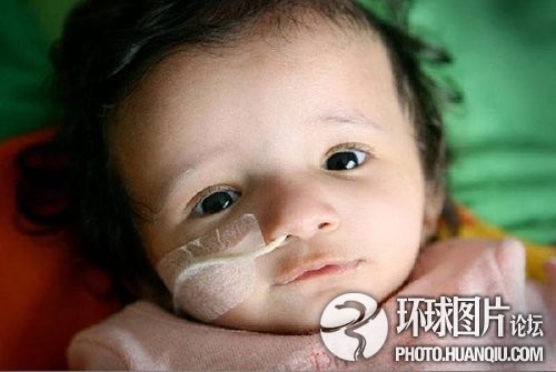 難以置信的罕見怪?。和浐粑?靜電過敏 聽鬧鐘響心臟停跳