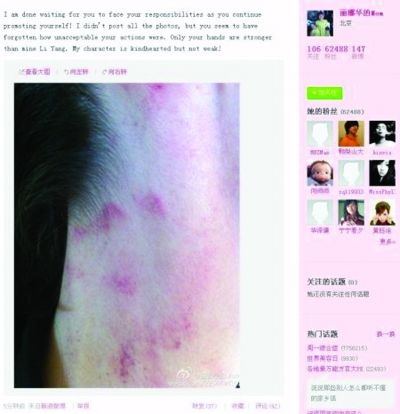 李陽(yáng)再次家暴！妻子曝光照片