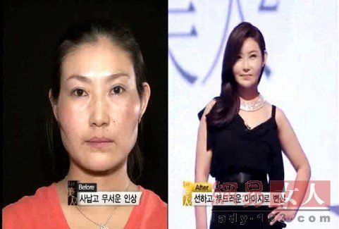 丑女變靚妹！韓國(guó)整容節(jié)目爆紅