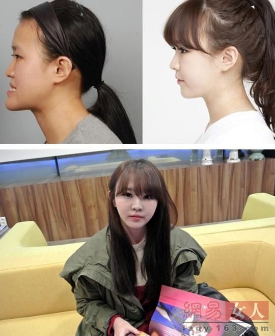 丑女變靚妹！韓國整容節(jié)目爆紅