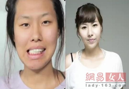 丑女變靚妹！韓國整容節(jié)目爆紅
