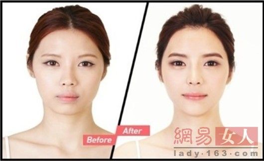 丑女變靚妹！韓國(guó)整容節(jié)目爆紅