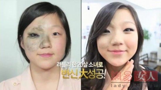 丑女變靚妹！韓國整容節(jié)目爆紅