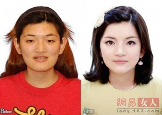 丑女變靚妹！韓國(guó)整容節(jié)目爆紅