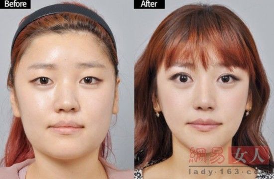 丑女變靚妹！韓國整容節(jié)目爆紅