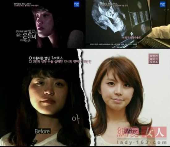 丑女變靚妹！韓國整容節(jié)目爆紅