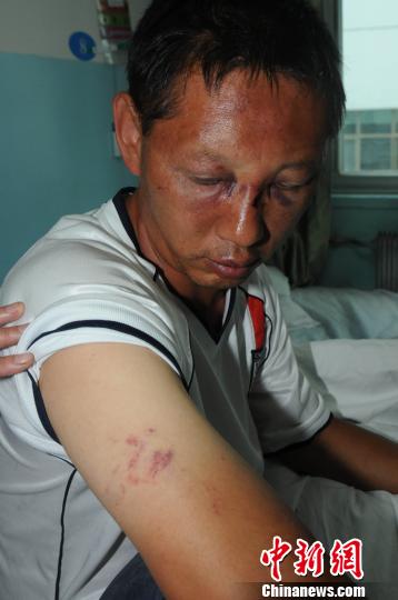 西寧警察處警被城管打傷槍險(xiǎn)被搶 當(dāng)?shù)卣{(diào)查(圖)