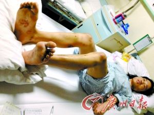 女子被疑不忠 遭男友虐待兩晝夜(圖)