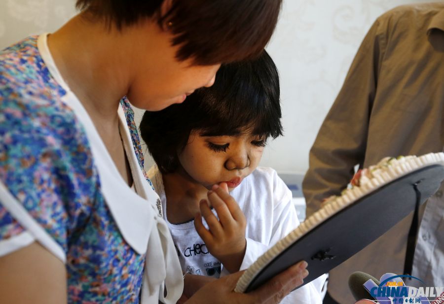 杭州：10歲輟學“毛孩”受關(guān)愛 接受面部激光脫毛