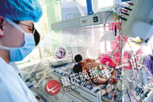 重慶22專家會診雙頭女嬰認(rèn)定屬單體 仍未脫離危險