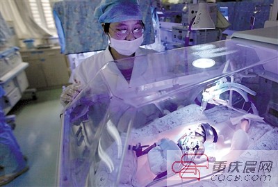 23周！重慶第一早產(chǎn)兒“筷子寶寶”正在頑強(qiáng)存活著