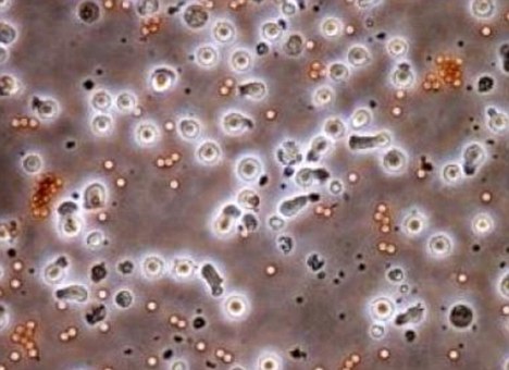 日本科學家造出“癌癥殺手”細胞 系全球首創(chuàng)有望注射使用
