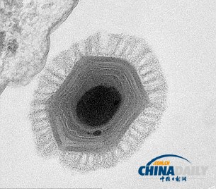 法國(guó)科學(xué)家發(fā)現(xiàn)前所未見的巨型病毒 或來自火星