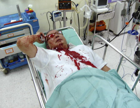 Gunmen attack Thai protest leader