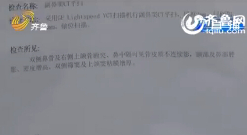 菏澤男孩鼻腔手術(shù)后藏20厘米長紗布 7個(gè)月后才發(fā)現(xiàn)