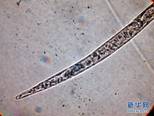 高清大圖：不只是食人魚(yú) 警惕“外來(lái)物種入侵”