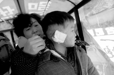 湖北男童遭二嬸割雙耳續(xù)：家里沒錢暫時出院
