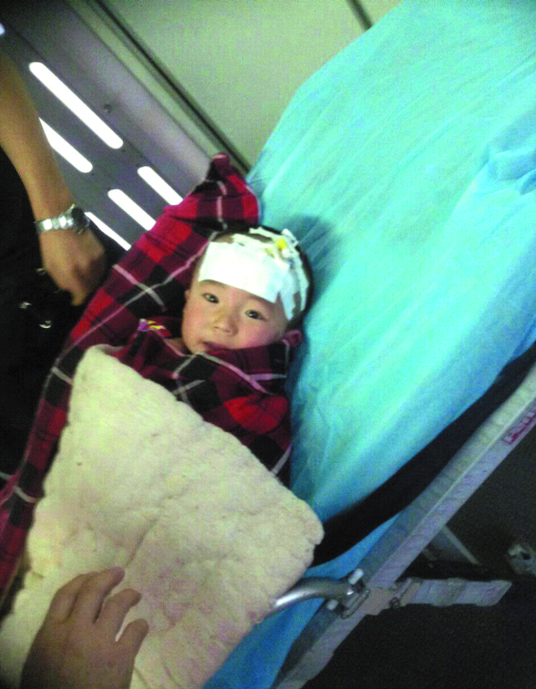 阿克蘇兩歲半男童掉進(jìn)開水鍋
