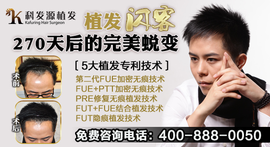 脫發(fā)的原因有哪些？科發(fā)源揭秘脫發(fā)三大原因