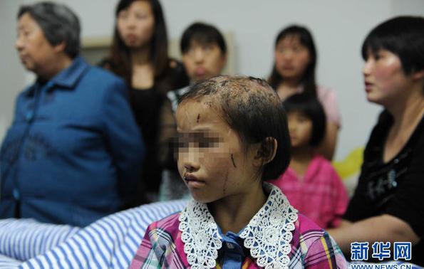 男子虐待親生女5年：開水燙頭、魚線縫嘴、跪碎玻璃(圖)