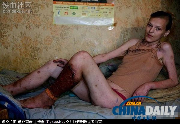 美麗蛻變！實(shí)拍吸毒女孩的戒毒歷程