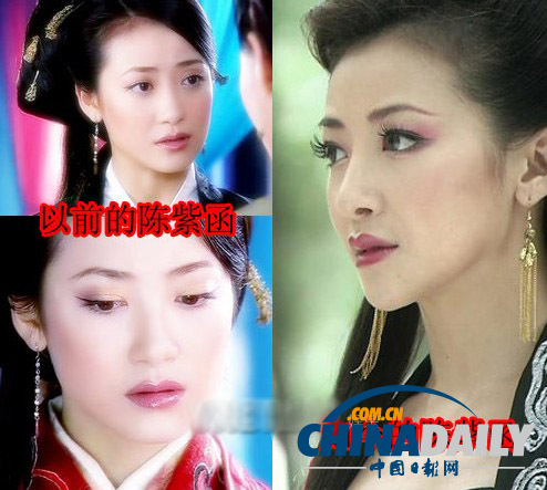 柳巖李小璐楊冪　女星整容前驚人對(duì)比照