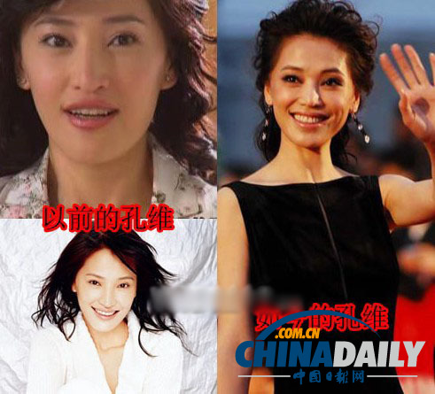 柳巖李小璐楊冪　女星整容前驚人對(duì)比照