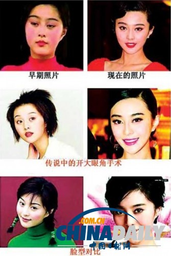 柳巖李小璐楊冪　女星整容前驚人對比照
