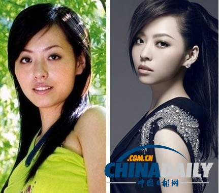 柳巖李小璐楊冪　女星整容前驚人對(duì)比照