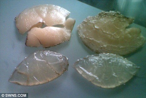 小小胸墊能救命！ 英國一女子遇嚴(yán)重車禍幸運(yùn)存活