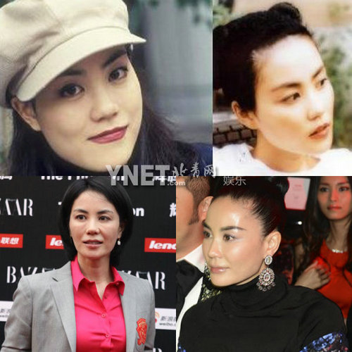 明星整容慘面癱 大S李小璐越發(fā)詭異