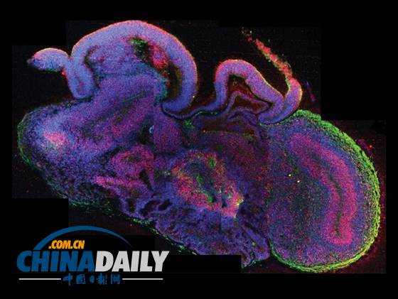 科學(xué)家利用干細(xì)胞培育人腦 達9周胎兒水平