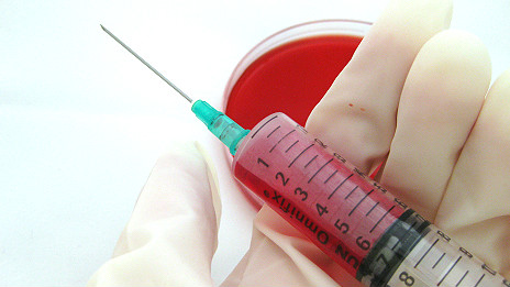 Ebola experimental treatment 抗埃博拉病毒試驗階段藥物