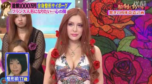 日本女?；?0萬美元整容30多次 欲成法式美女
