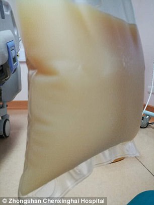 中山男子腹痛緊急送醫(yī)搶救，檢出“牛奶血”！