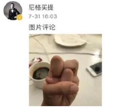 一般人做不出的張一山秋水誓？醫(yī)生：這是??！