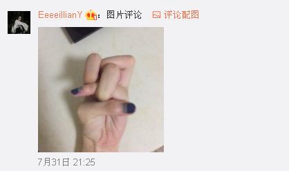 一般人做不出的張一山秋水誓？醫(yī)生：這是??！