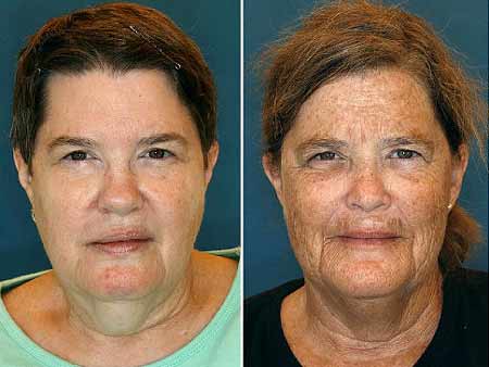 皮膚老化？生活習(xí)慣惹的禍