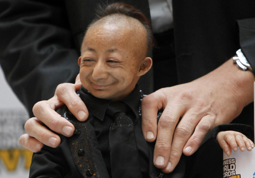 World's shortest man dies at 21