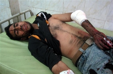 An injured Iraqi man lies at a hospital after a suicide car bomber crashed into an Iraqi police checkpoint, killing 33 and injuring 75 at an entrance to Sadr City, the capital's biggest Shiite Muslim neighborhood, in Baghdad, Iraq, Wednesday, April 18, 2007. Four large bombs exploded in mostly Shiite areas of Baghdad on Wednesday, killing at least 164 people and wounding scores �� the deadliest day in the city since the start of the U.S.-Iraqi campaign to pacify the capital. (AP 
